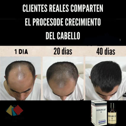 🌿 SERUM 10™ | Solución Avanzada para Combatir la caida del cabello y Estimular su rapido crecimiento ✨