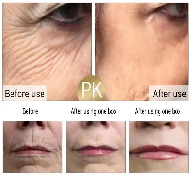 Crema Facial Antiedad  de Niacinamida - VENZEN✨