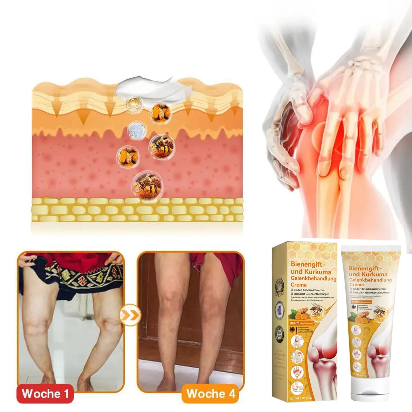 FATONG™ Crema Para Aliviar Dolor en  Las Articulaciones 🐝✨ LLEVA 2 POR EL VALOR DE 1